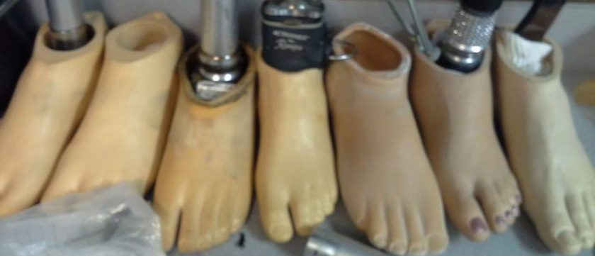 Image of white skin tone prosthetic feet