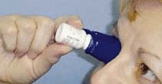 blue eye dropper cover attached to a white bottle of eye drops held by a white woman